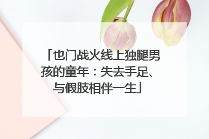 也门战火线上独腿男孩的童年：失去手足、与假肢相伴一生